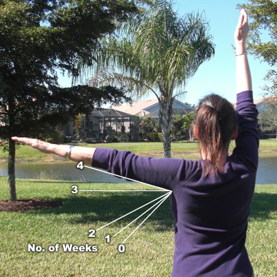 Recovery at 4 weeks Rotator Cuff Injury Treatment - week 4